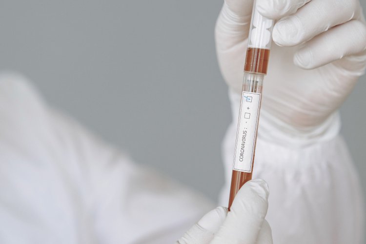 Europos Komisija investuos 400 milijonų eurų, kad užtikrintų sąžiningą prieigą prie Covid-19 vakcinų