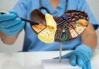 Jūsų kepenys tyliai kenčia, o jūs to net neįtariate? Gydytoja paaiškina, kas lemia kepenų suriebėjimą ir kaip to išvengti